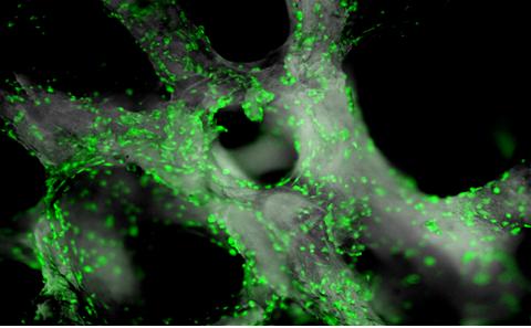 Skeletal stem cells on human bone